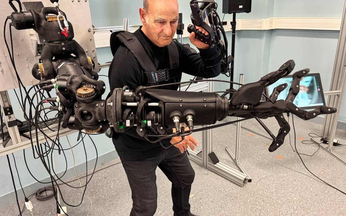 Stelarc – Hypertrophic Ambidextrous Hand and Arm