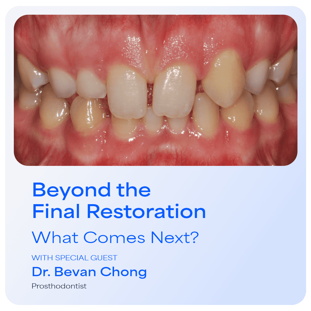 Beyond the Final Restoration. What comes next?