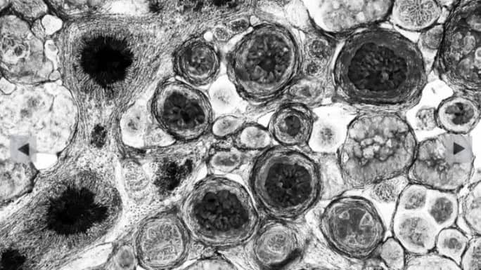 Tertulia: Los virus, héroes y villanos